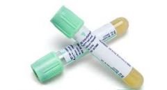 4.5 mLBD Vacutainer® PST tube with polymer gel and lithium heparin 84 USP units for plasma separation