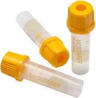 BD Microtainer® Tube with BD Microgard™ Closure,400-600 uL