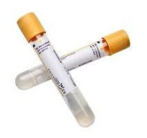4 mL, BD Vacutainer® SST tube with silica clot activator, polymer gel, silicone-coated interior